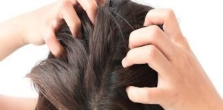 Effective Treatments to Manage Psoriasis on the Scalp and Head Naturally